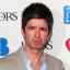 Streatham Guardian: Noel Gallagher 'doesn't mind blurry vision but is terrified of going bald' Streatham Guardian: Noel Gallagher 'doesn't mind blurry vision but is terrified of going bald'